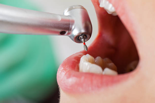 Best Emergency Dentist for Knocked-Out Tooth in Salem, MO